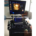 4D color doppler ultrasound price & 3D color doppler ultrasound scanner used in hospitals